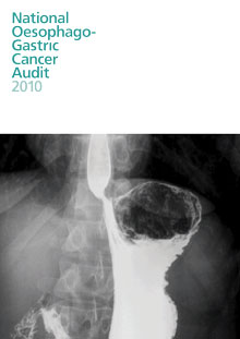 National Oesophago- Gastric Cancer Audit 2010