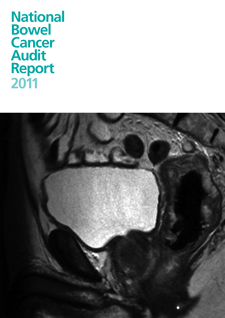 national bowel cancer audit report 2011