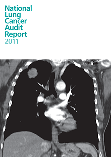 national lung cancer audit 2011