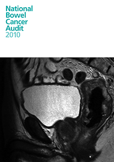 national bowel cancer audit 2010