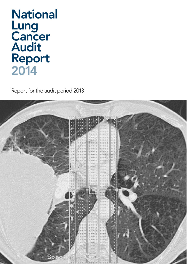 National lung cancer audit report 2014