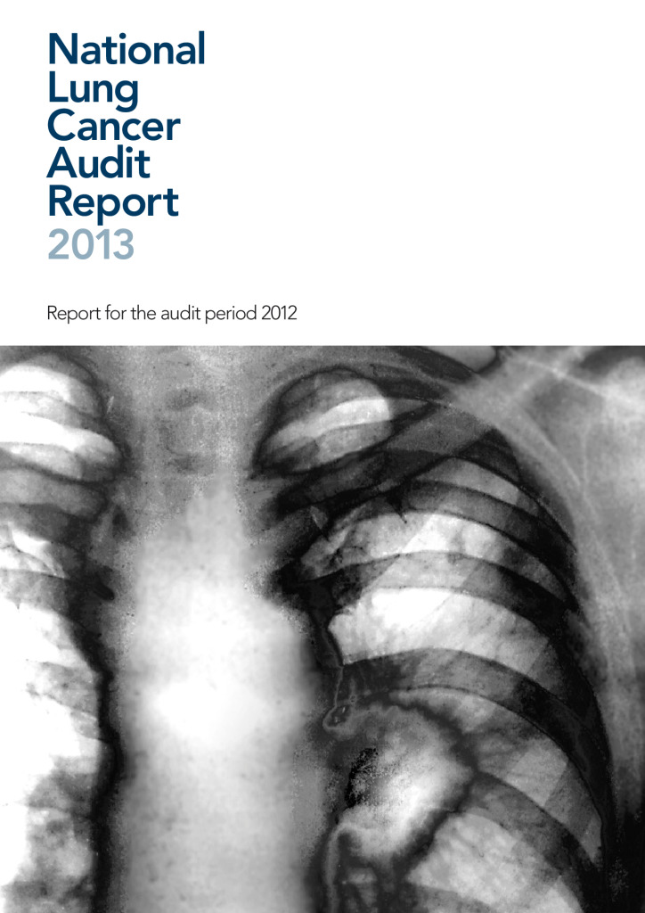 National Lung Cancer Audit Report 2013