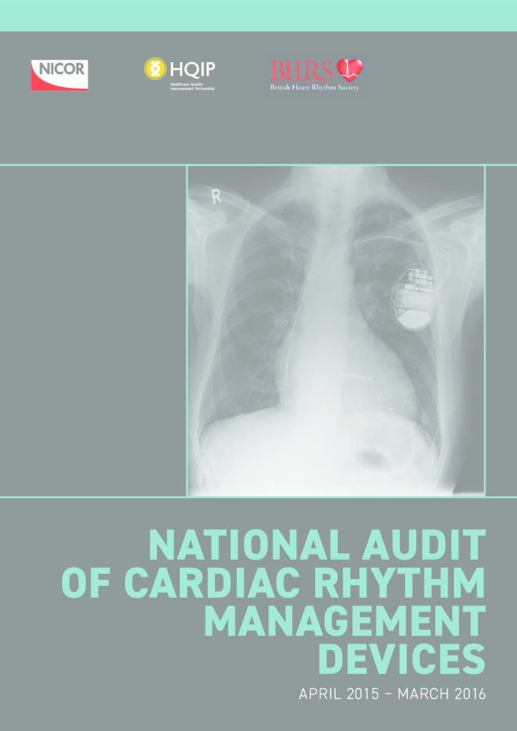 National Audit of Cardiac Rhythm Management Devices April 2015 – March 2016