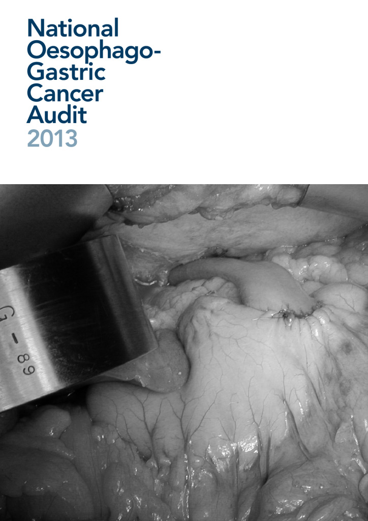National Oesophago- Gastric Cancer Audit 2013