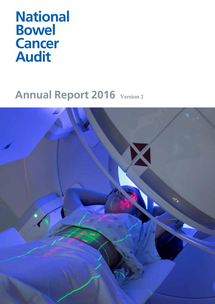 National Bowel Cancer Audit Annual Report 2016