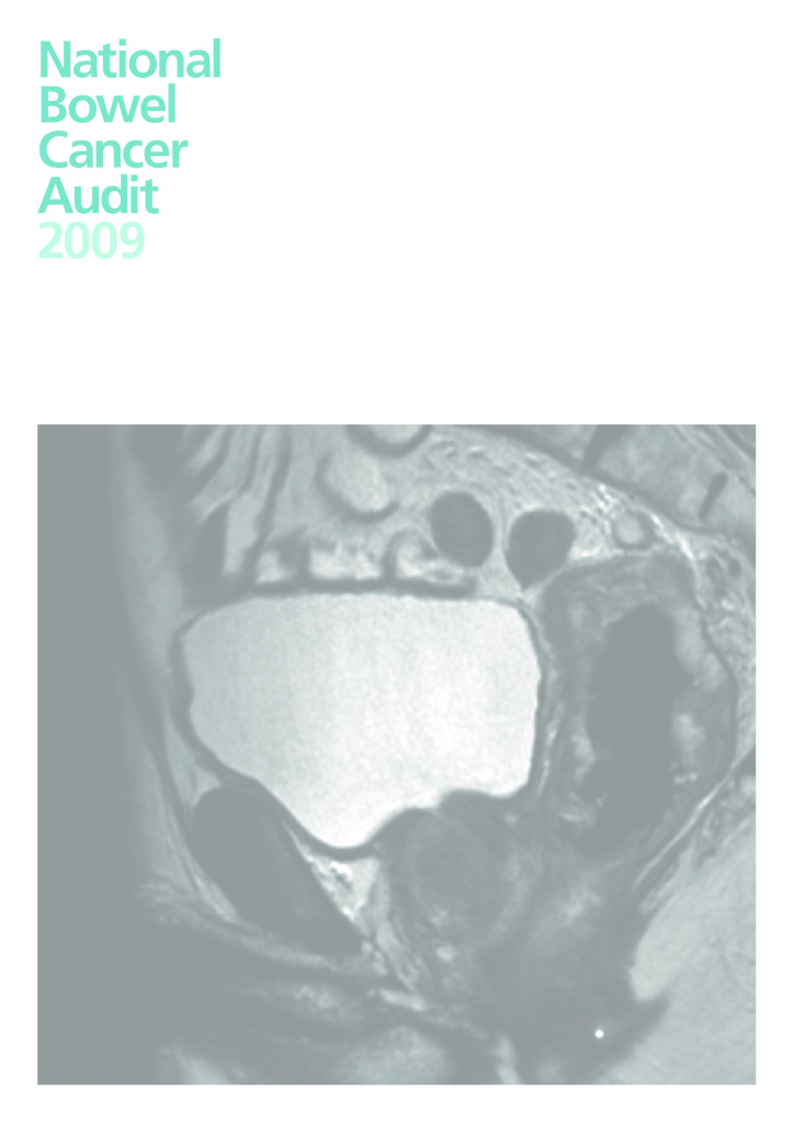 National Bowel Cancer Audit 2009