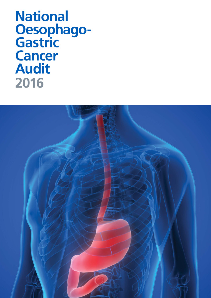 National Oesophago-Gastric Cancer Audit 2016