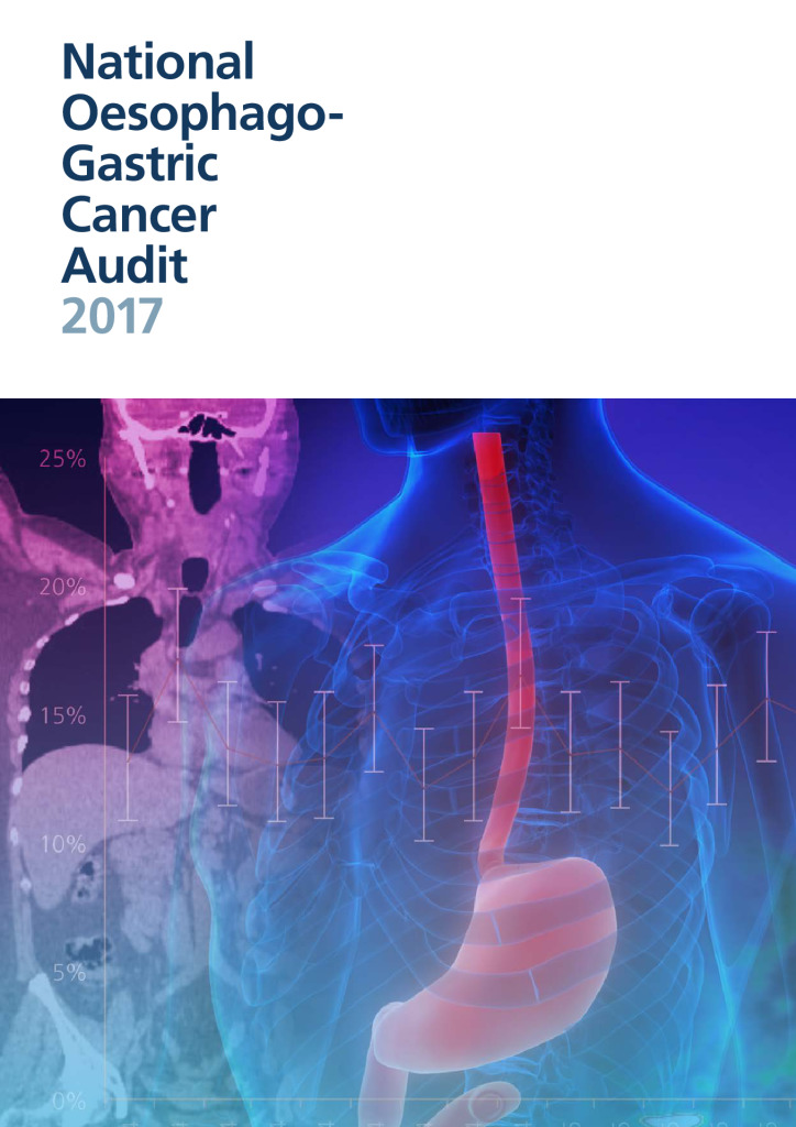 National Oesophago-Gastric Cancer Audit Report 2017