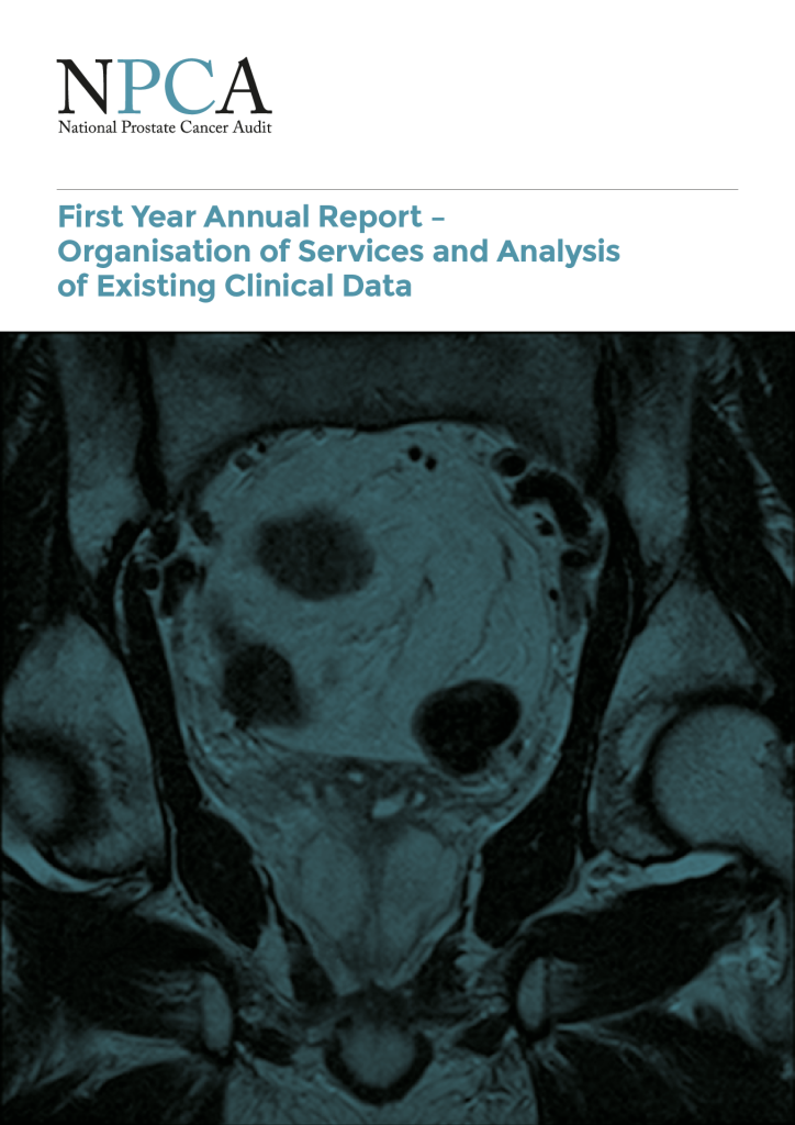 National prostate cancer audit report 2014