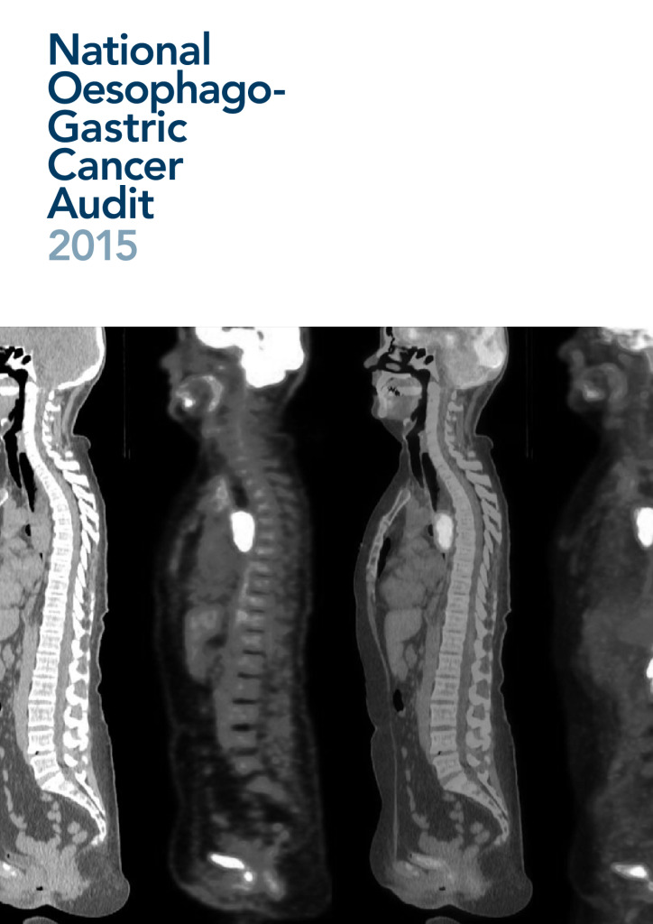 National Oesophago-Gastric Cancer Audit report 2015