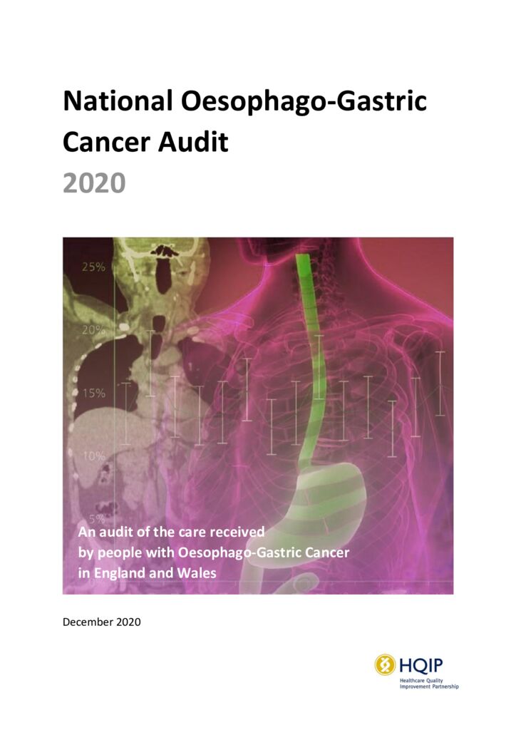 National Oesophago-Gastric Cancer Audit 2020