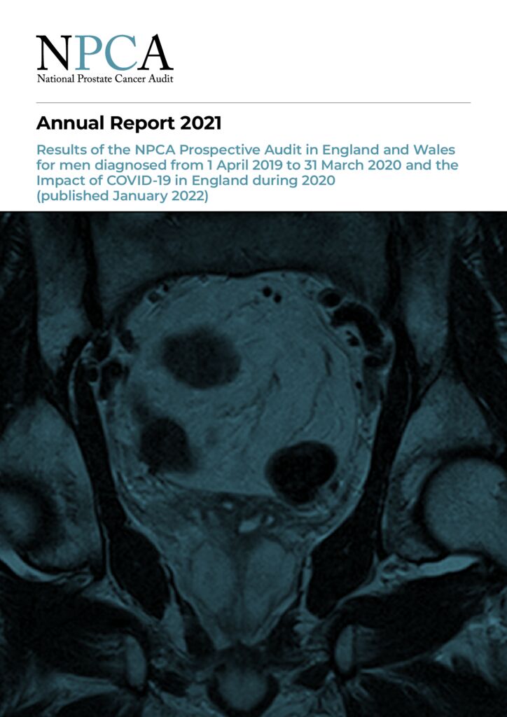 National Prostate Cancer Audit Annual Report 2021