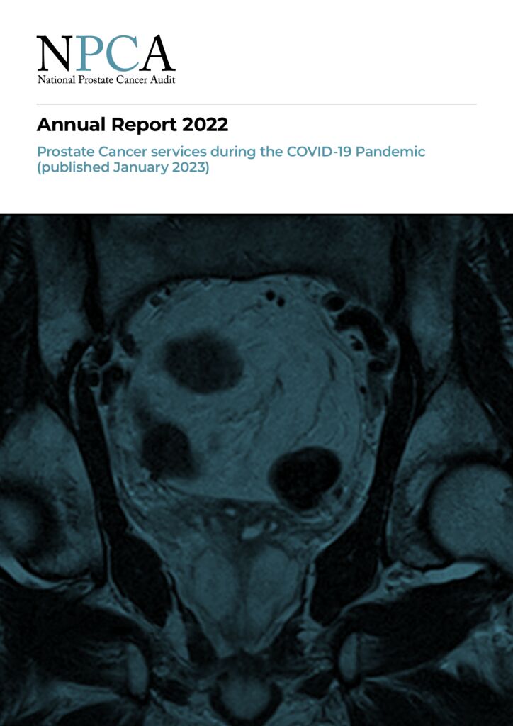 Annual report 2022 – Prostate cancer services during the COVID-19 pandemic (NPCA)