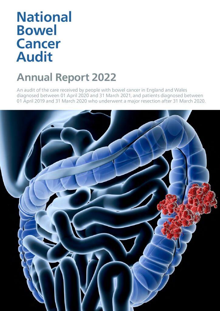 Bowel cancer annual report 2022 (NBOCA)