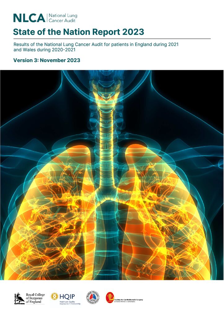 National Lung Cancer Audit (NLCA) – State of the nation report 2023