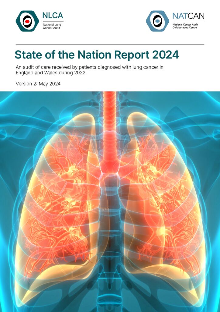 National Lung Cancer Audit (NLCA) State of the Nation report
