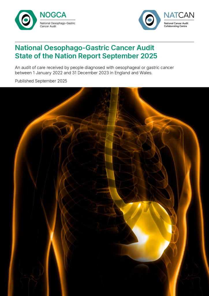 Oesophago-Gastric Cancer Report 2025 (NOGCA/NATCAN)