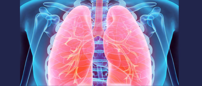 Lung cancer